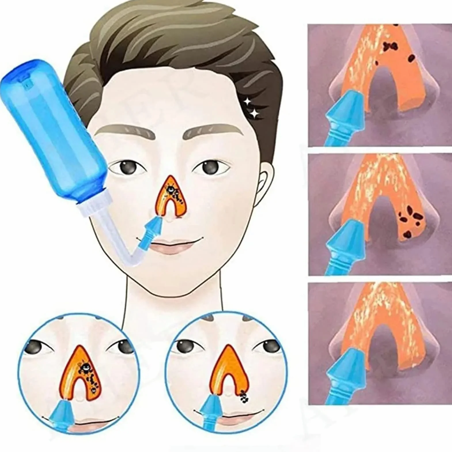 Kit de Rinçage Nasal Neti Pot 300 ml Qualité Alimentaire pour Enfants Adultes