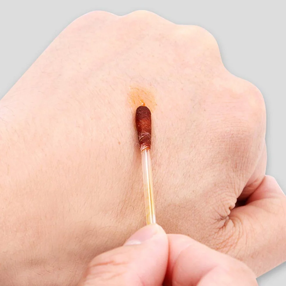 Exceart Lot de 100 cotons-tiges médicaux jetables désinfectés à l'iode