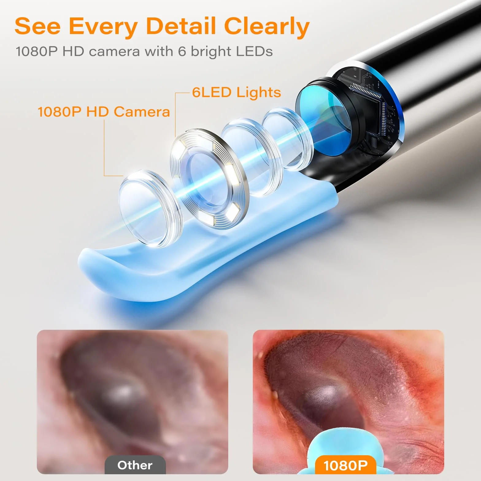 Otoscope Cure Oreille avec Écran Intégré et Gyroscope, Caméra 1080P HD 6 LED, Kit Élimination Cérumen